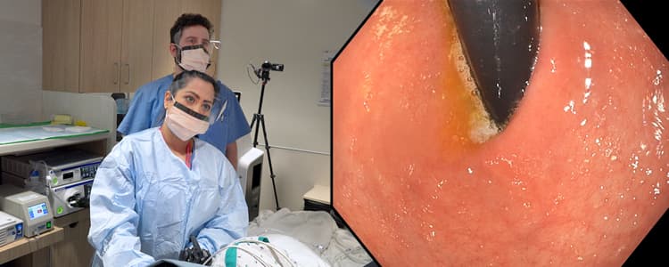 Endoscopic Evaluation of a Twisted Gastric Sleeve Causing Severe Reflux and Epigastric Pain